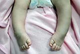 Straighter feet - Click for larger image