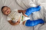 Blue casts for Ellie - Click for larger image