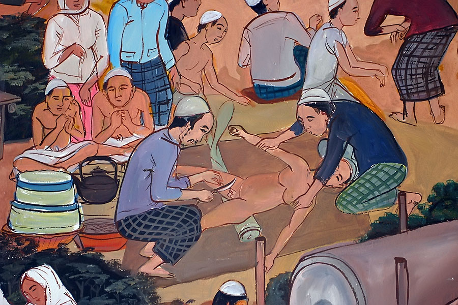 Male circumcision - Muslims in Southern Thailand