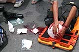 A bad accident that I witnessed last year  - Click for larger image