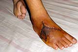 ... and here's a close-up of his foot - Click for larger image